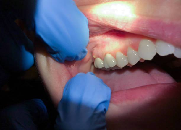 Best Dentist Open on Weekends  in Del City, OK