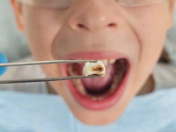 Best Dentist Open Late Near Me  in Del City, OK